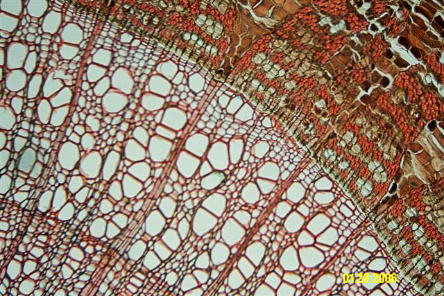 Bob's microphotograph #2